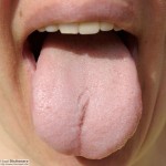 pale tongue