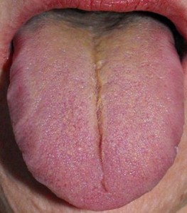 spine tongue toxins colon